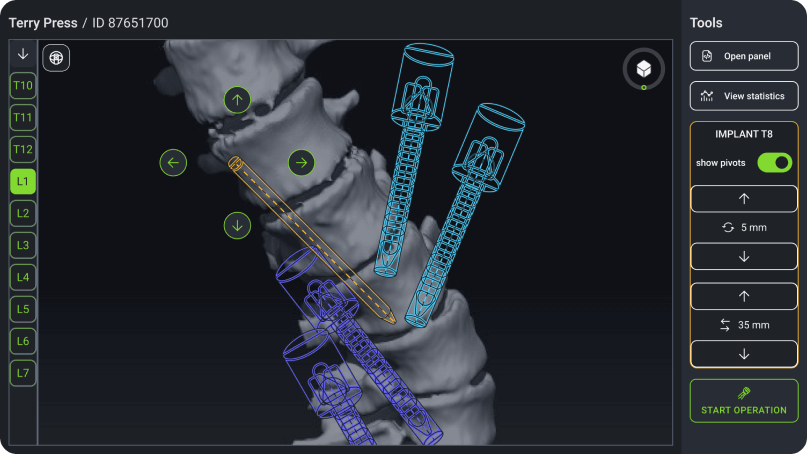 Spine surgery software for Windows